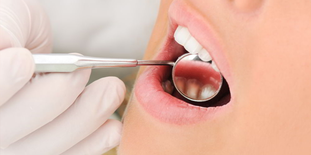 dentist constanta, tratamentul cariilor