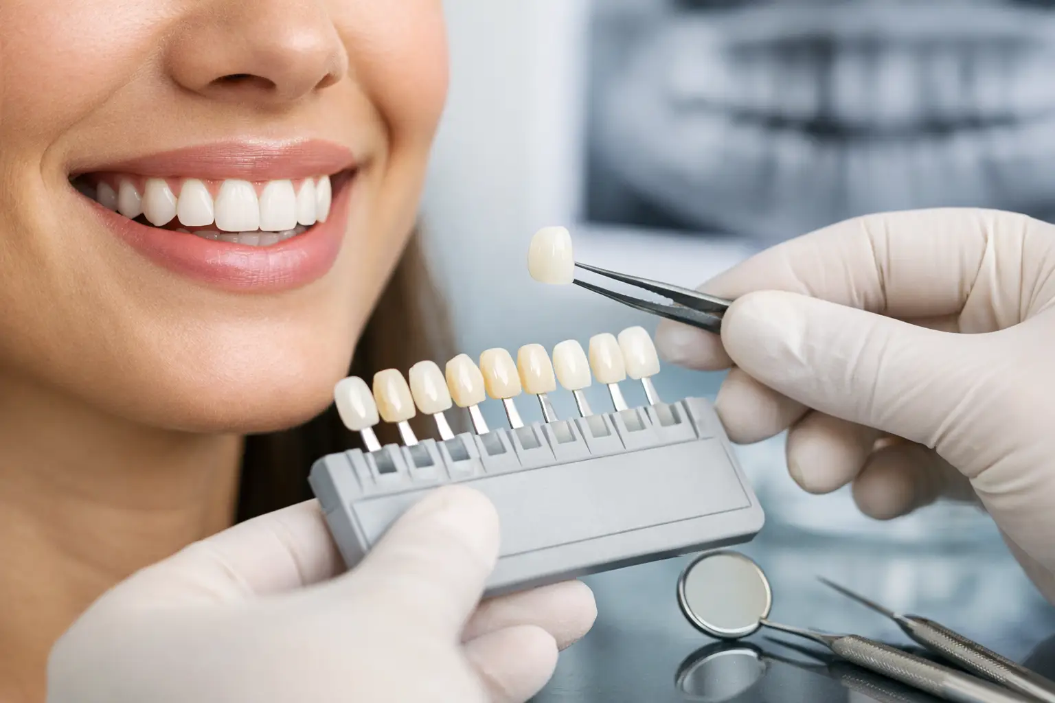 Cum alegi fațetele dentare potrivite pentru tine